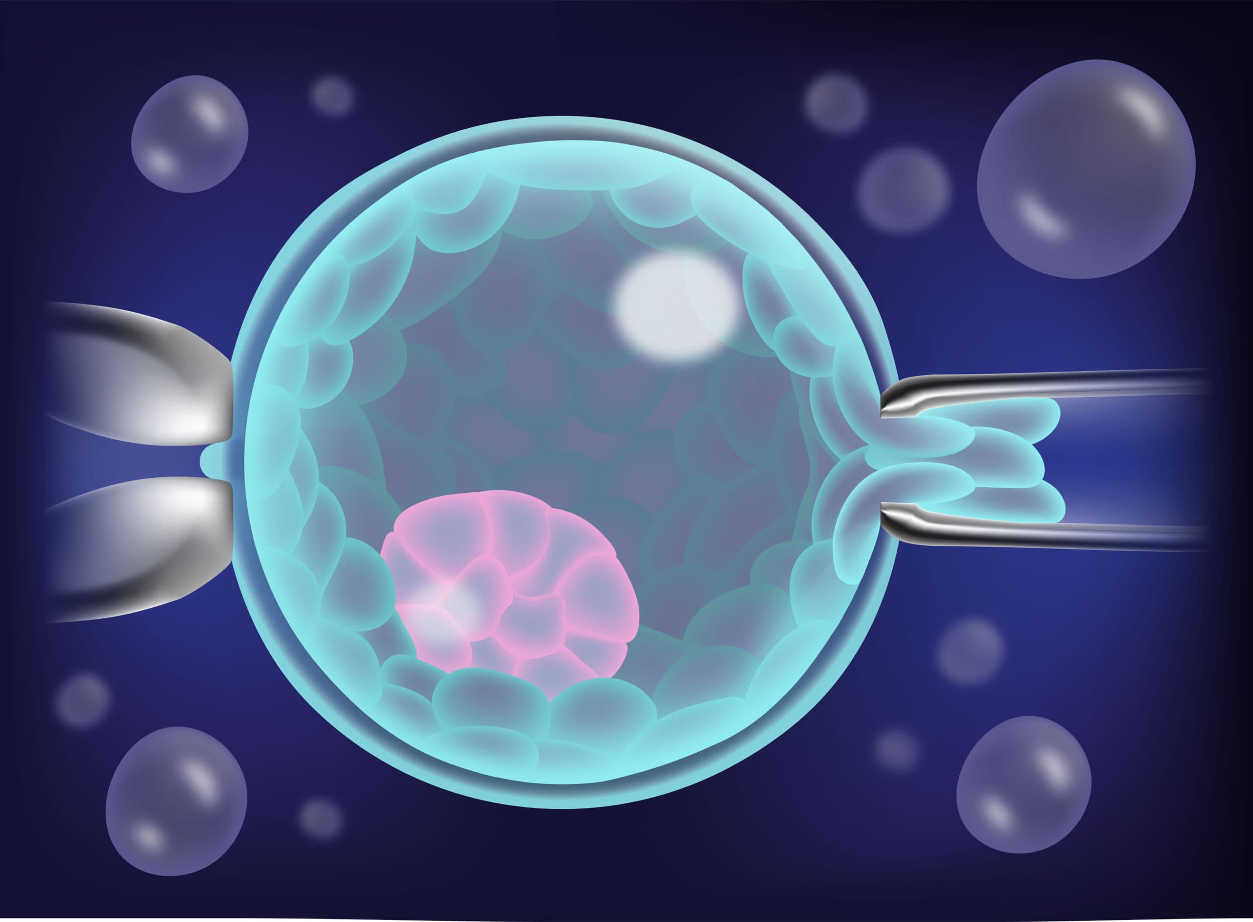 Pre Implantation Genetic Testing