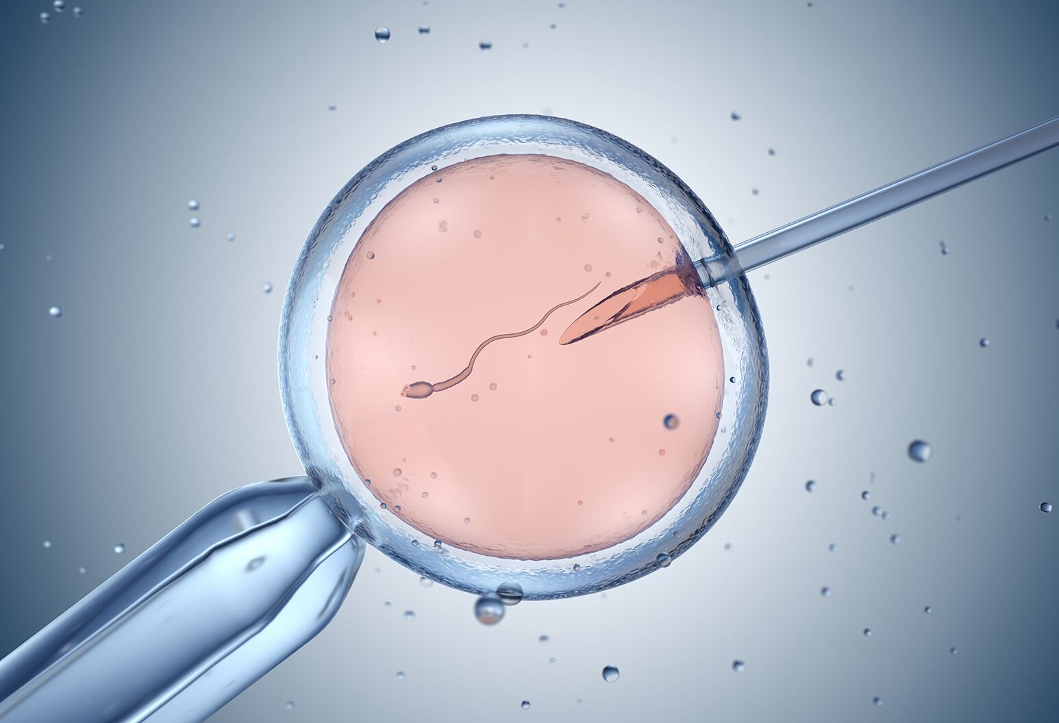 Fertility Treatment