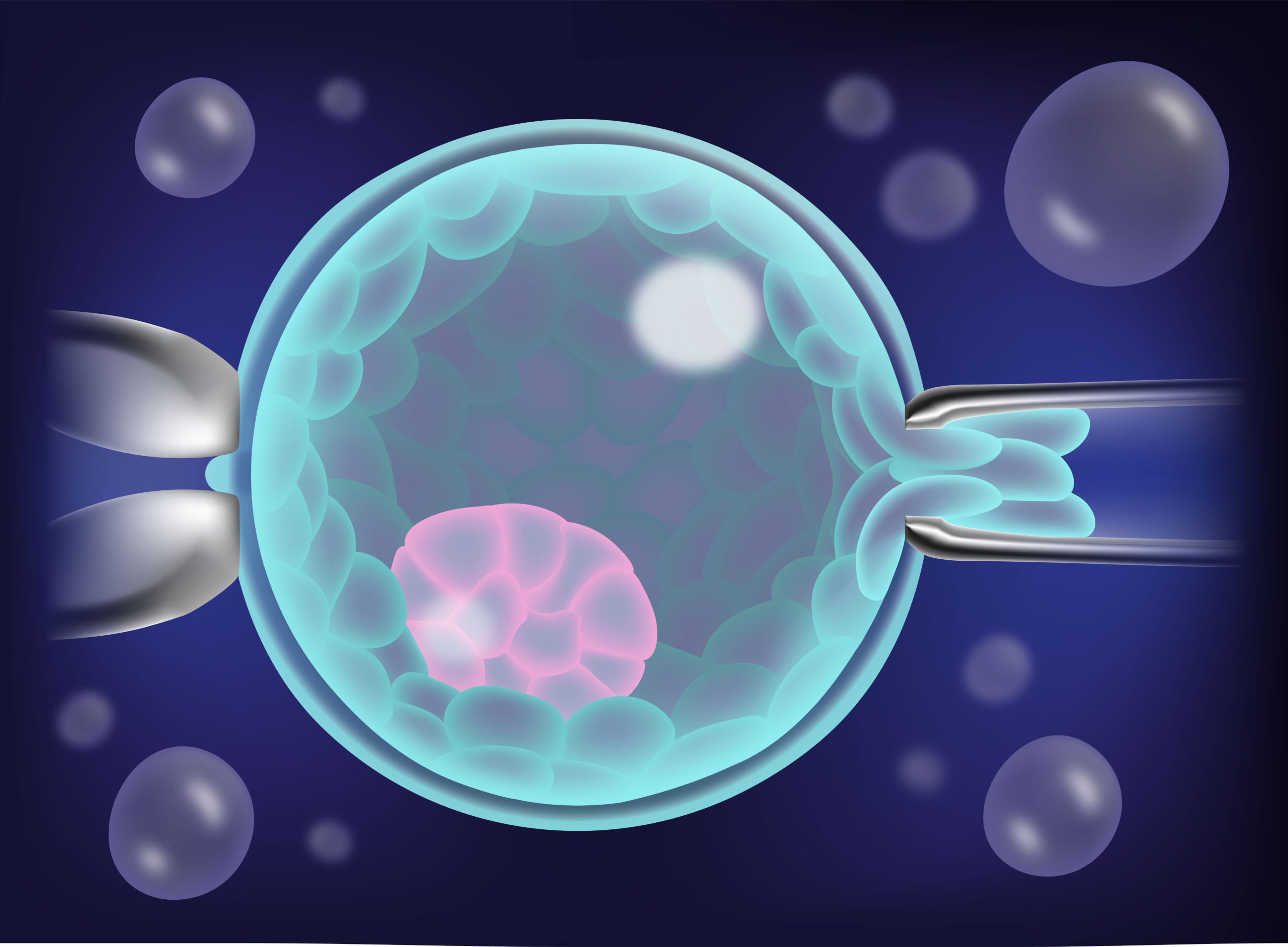Pre Implantation Genetic Testing